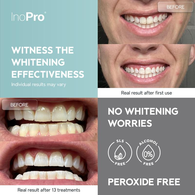 Inopro Natural Teeth Whitening Strips - Pack of 28