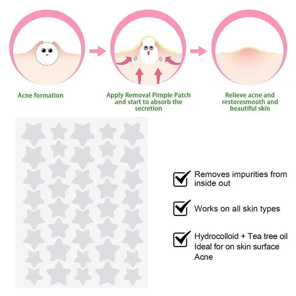 40Pcs Pimple Patches | Colorful Star-Shaped