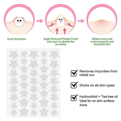 40Pcs Pimple Patches | Colorful Star-Shaped