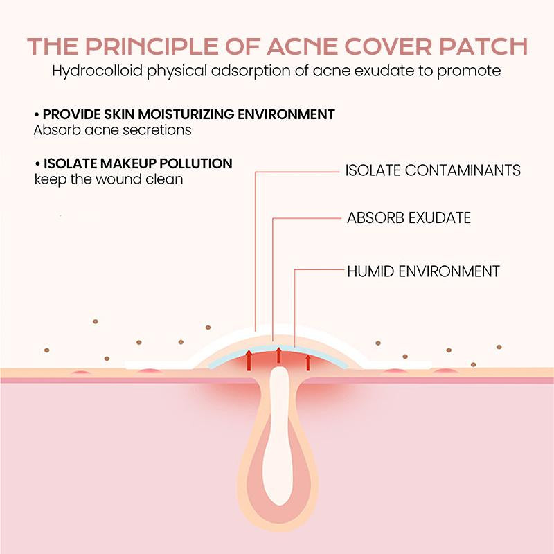 Pimple Patches | Hyaluronic Acid