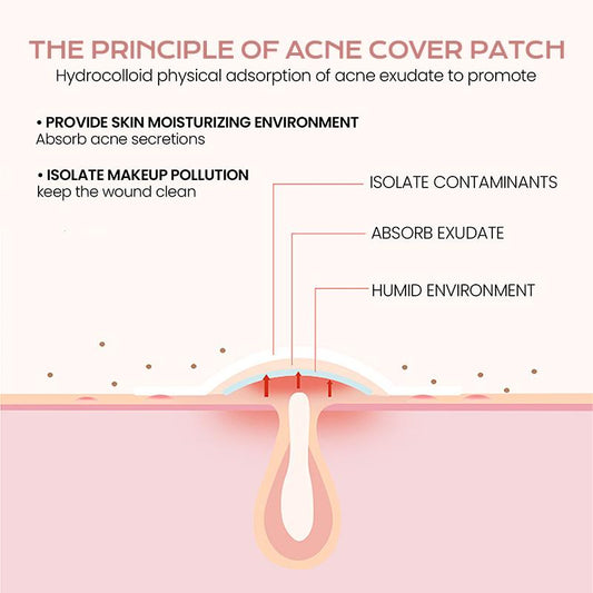 Pimple Patches | Hyaluronic Acid
